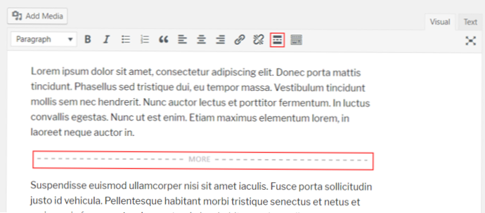 create a read more link for post and archives